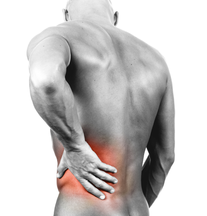 strappo muscolare